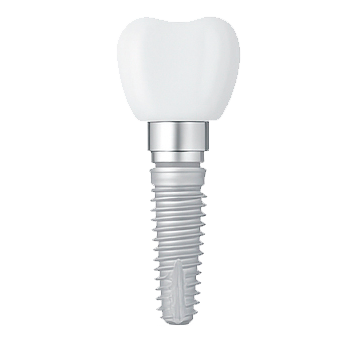 Implante dental convencional atornillado